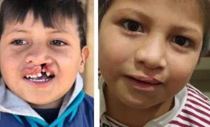 Fundación Áurea (2)