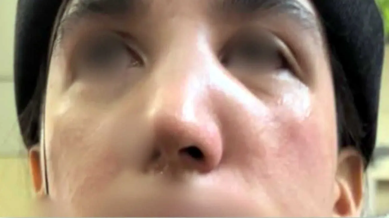 brutal-ataque-a-pareja-de-lesbianas-en-caba-20250206-1962644