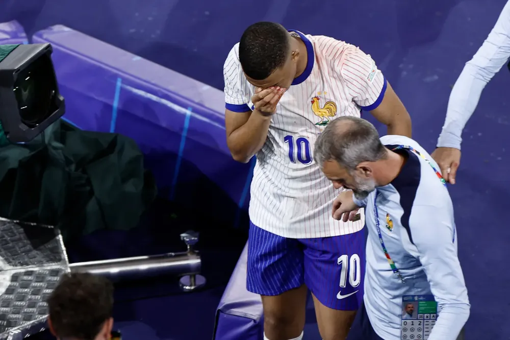 Kylian Mbappé se rompió la naríz (1)